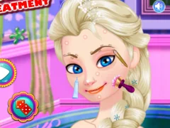 Ice Queen Acne Treatment เกมออนไลน์