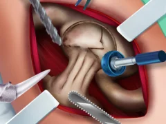 Spill Elsa Hips Surgery online
