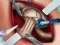 Elsa Hips Surgery — free online game