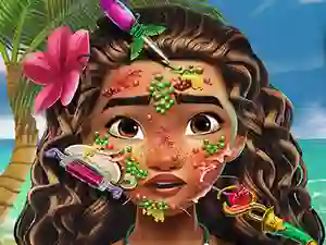 Moana Skin Doctor — free online game