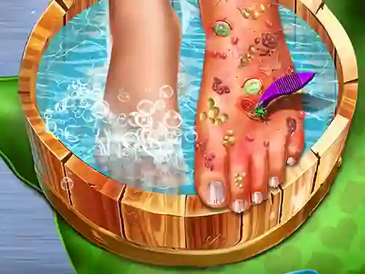 Feet Skin Doctor — free online game