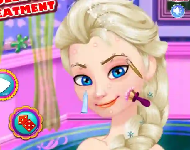 Ice Queen Acne Treatment — free online game