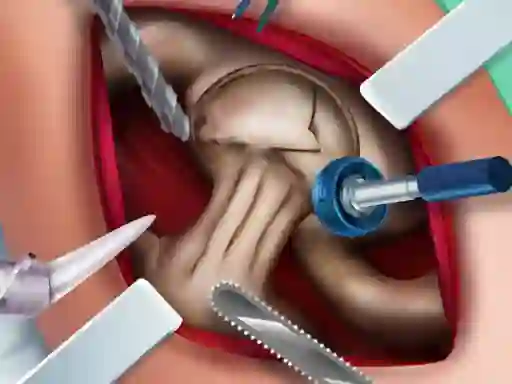 Elsa Hips Surgery — free online game